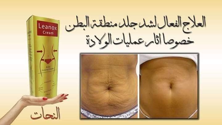 كريم لينوكس لحرق الدهون و شد الجسم
