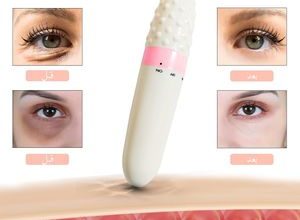 قلم مساج هزاز متعدد الاستخدام 01012187661