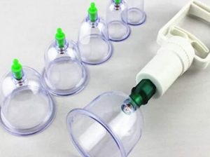 حجامة إسلامية طبية 6 قطع 01012187661